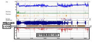 ②